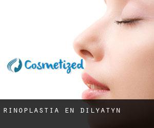 Rinoplastia en Dilyatyn