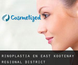 Rinoplastia en East Kootenay Regional District
