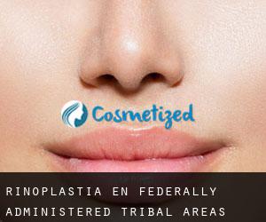Rinoplastia en Federally Administered Tribal Areas