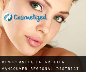 Rinoplastia en Greater Vancouver Regional District