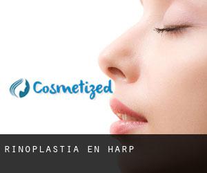 Rinoplastia en Harp