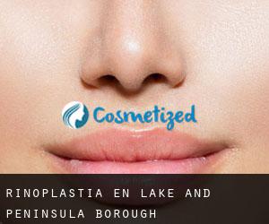 Rinoplastia en Lake and Peninsula Borough