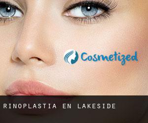 Rinoplastia en Lakeside