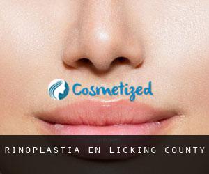Rinoplastia en Licking County