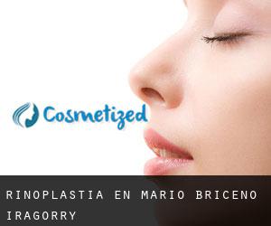 Rinoplastia en Mario Briceño Iragorry