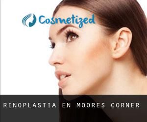 Rinoplastia en Moores Corner