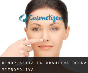 Rinoplastia en Obshtina Dolna Mitropoliya
