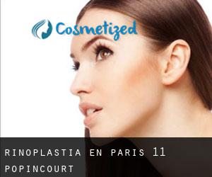 Rinoplastia en Paris 11 Popincourt
