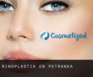 Rinoplastia en Petranka