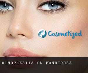 Rinoplastia en Ponderosa