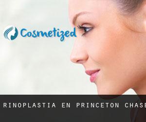 Rinoplastia en Princeton Chase