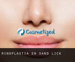 Rinoplastia en Sand Lick