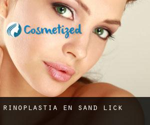 Rinoplastia en Sand Lick