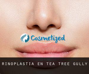 Rinoplastia en Tea Tree Gully