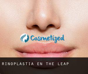Rinoplastia en The Leap