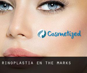 Rinoplastia en The Marks