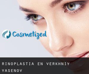 Rinoplastia en Verkhniy Yasenov