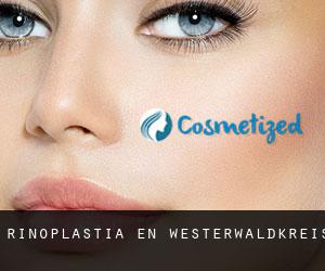 Rinoplastia en Westerwaldkreis Rinoplastia en Westerwaldkreis