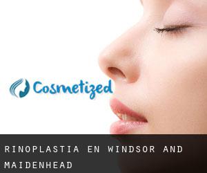 Rinoplastia en Windsor and Maidenhead Rinoplastia en Windsor and Maidenhead