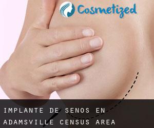 Implante de Senos en Adamsville (census area)