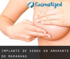 Implante de Senos en Amarante do Maranhão