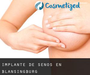 Implante de Senos en Blansingburg