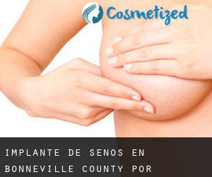 Implante de Senos en Bonneville County por población - página 1