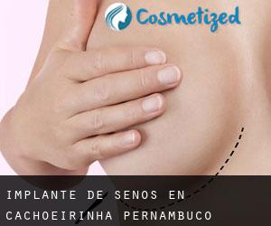 Implante de Senos en Cachoeirinha (Pernambuco)