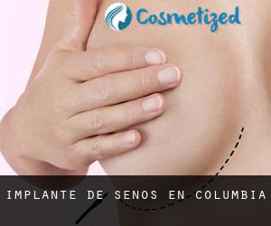 Implante de Senos en Columbia Implante de Senos en Columbia