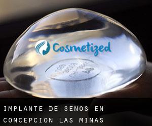 Implante de Senos en Concepción Las Minas