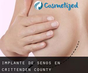 Implante de Senos en Crittenden County