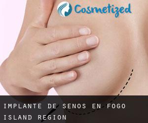 Implante de Senos en Fogo Island Region