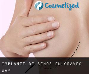 Implante de Senos en Graves Way