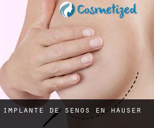 Implante de Senos en Hauser