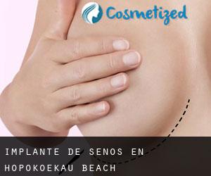 Implante de Senos en Hopokoekau Beach