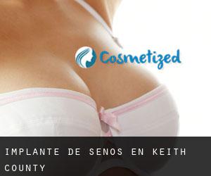 Implante de Senos en Keith County