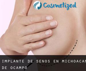 Implante de Senos en Michoacán de Ocampo