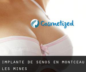 Implante de Senos en Montceau-les-Mines