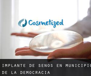 Implante de Senos en Municipio de La Democracia Implante de Senos en Municipio de La Democracia