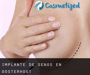 Implante de Senos en Oosterhout