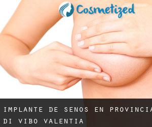 Implante de Senos en Provincia di Vibo-Valentia
