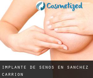 Implante de Senos en Sanchez Carrion