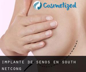 Implante de Senos en South Netcong