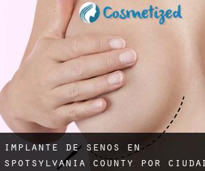 Implante de Senos en Spotsylvania County por ciudad - página 1