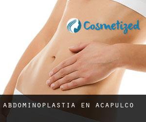Abdominoplastia en Acapulco