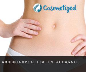 Abdominoplastia en Achagate