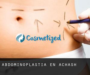 Abdominoplastia en Achash