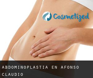 Abdominoplastia en Afonso Cláudio