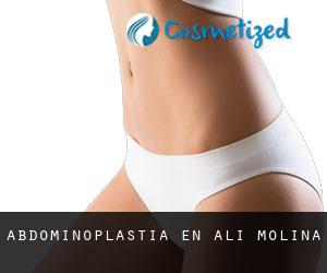 Abdominoplastia en Ali Molina