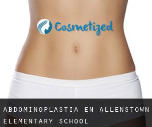 Abdominoplastia en Allenstown Elementary School